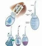 Surgical Drainage Bag